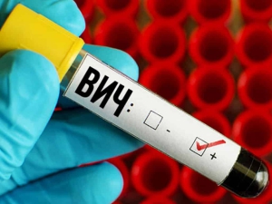 Обнаружен вирус иммунодефицита человека (ВИЧ)