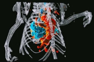 Новозеландскими учёными в Женеве был представлен рентгеновский аппарат, который способен делать трёхмерные цветные снимки