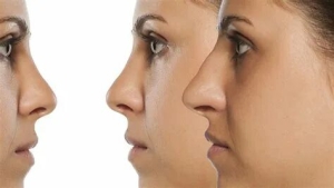 День всех курносых