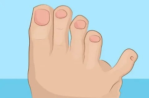 День независимости мизинца на правой ноге