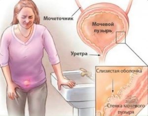 День повиновения мочевому пузырю