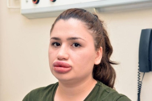 День надутых губ и вздернутых хвостов